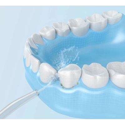 Ирригатор Xiaomi MiJia Oral Irrigator White (MEO701)