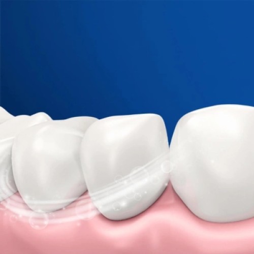 Электрическая зубная щетка Oral-B Vitality D103.413.3 Protect x clean (4210201427124)