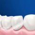 Электрическая зубная щетка Oral-B Vitality D103.413.3 Protect x clean (4210201427124)