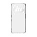 Чехол для мобильного телефона Armorstandart Air Force Nothing Phone (3a) Camera cover Clear (ARM85468) Чехол для мобильного телефона Armorstandart Air Force Nothing Phone (3a) Camera cover Clear (ARM85468)