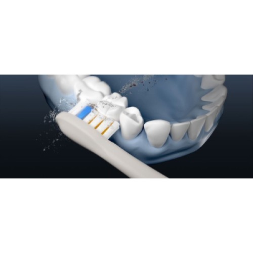 Электрическая зубная щетка Soocas T03 Neos White