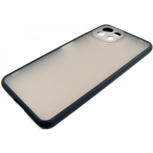 Чехол для мобильного телефона Dengos Matte Xiaomi Mi 11 Lite (black) (DG-TPU-MATT-75)